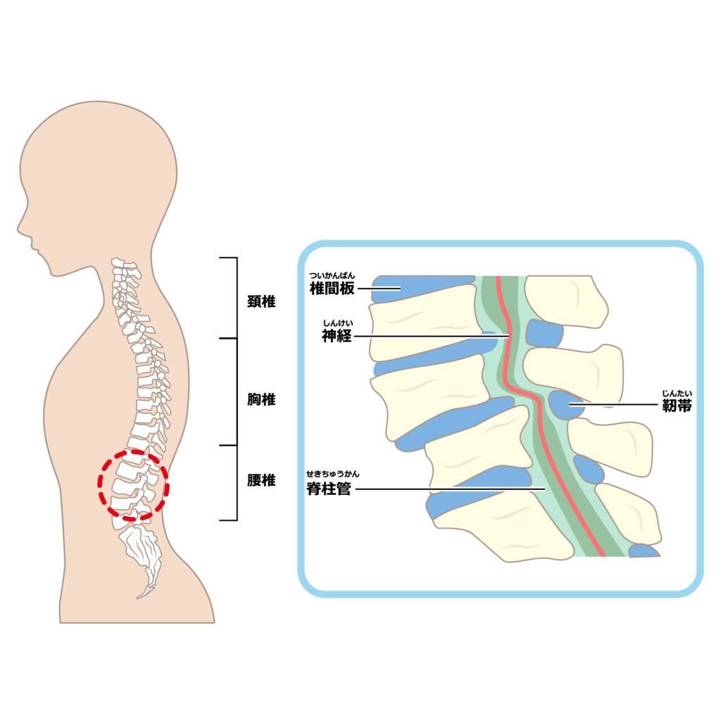 脊椎管狭窄症と整体