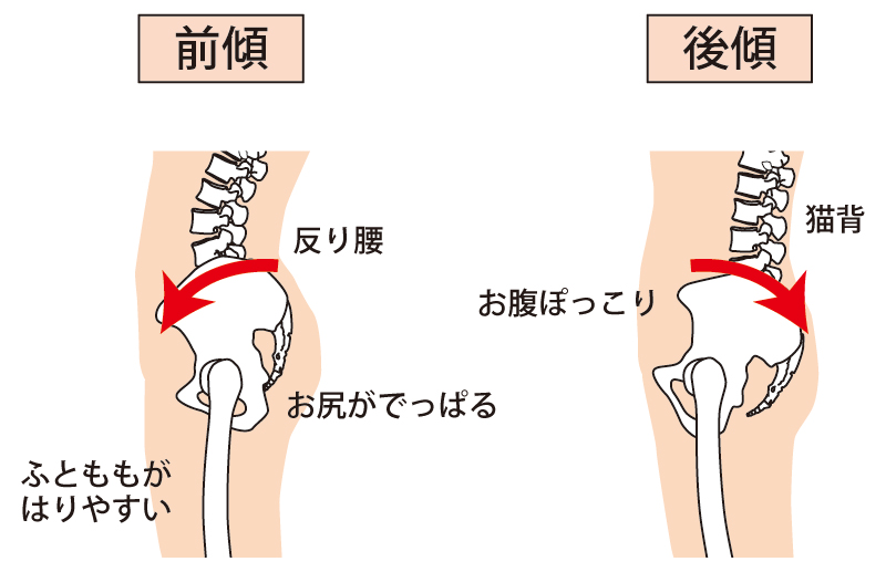 見逃していませんか？骨盤のゆがみが引き起こす7つの体調不良